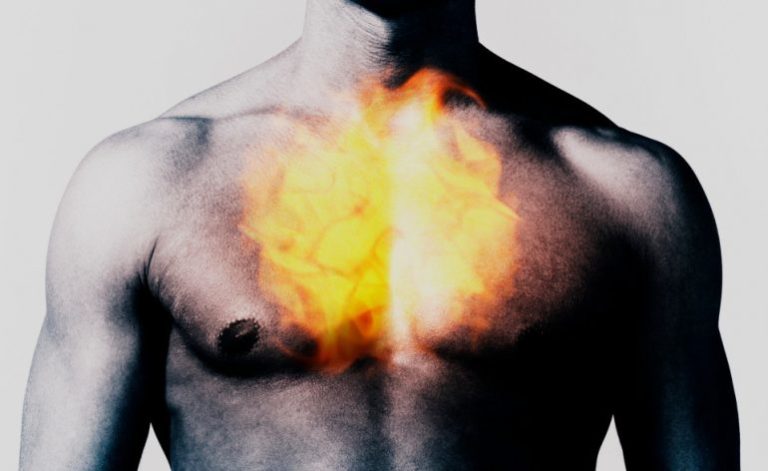 Tips to avoid heartburn